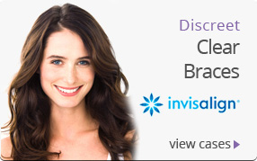 invisalign