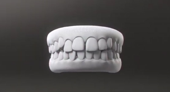 How Invisalign Works